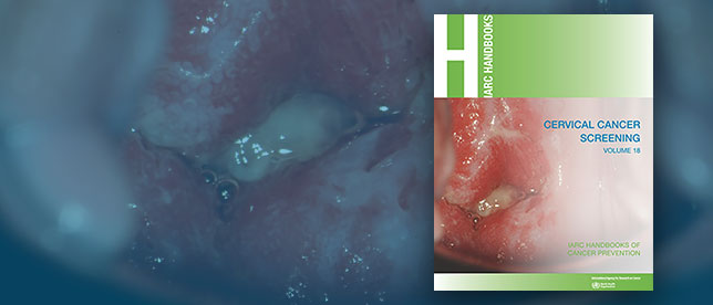 Cervical Cancer Screening
