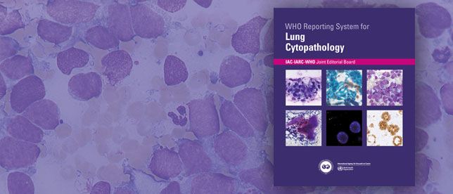 WHO Reporting System for Lung Cytopathology