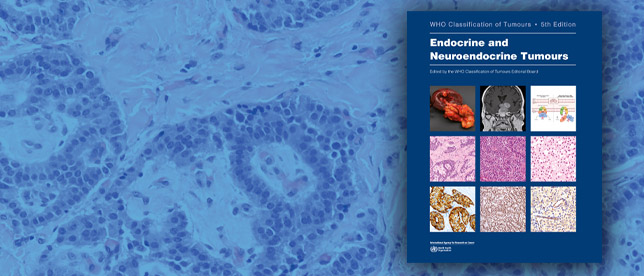 Endocrine and Neuroendocrine Tumours